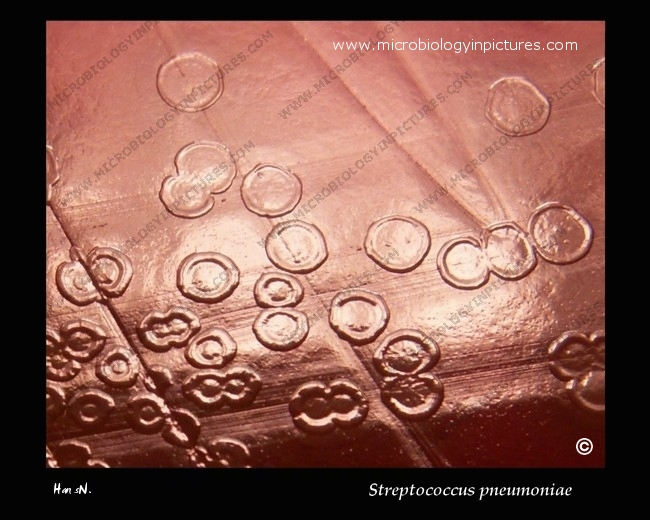 colonies of pneumococcus